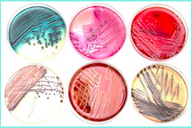 Microbial samples